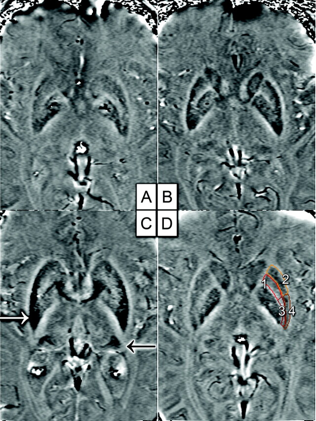 Fig 2.