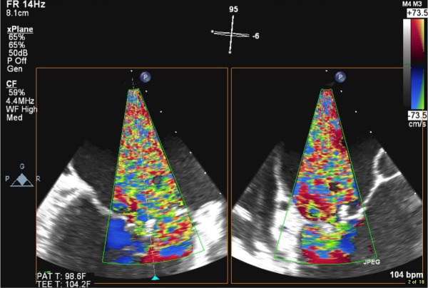 Figure 4