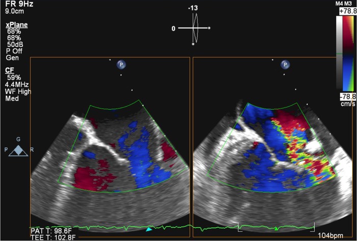 Figure 3