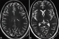 Figure 1(A and B)