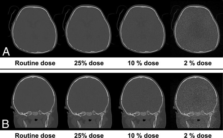 Fig 3.