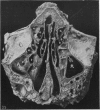 246-1