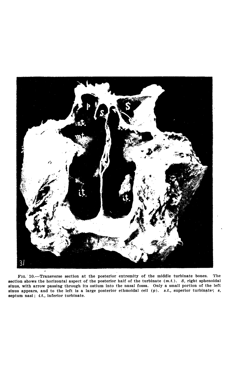 242-2