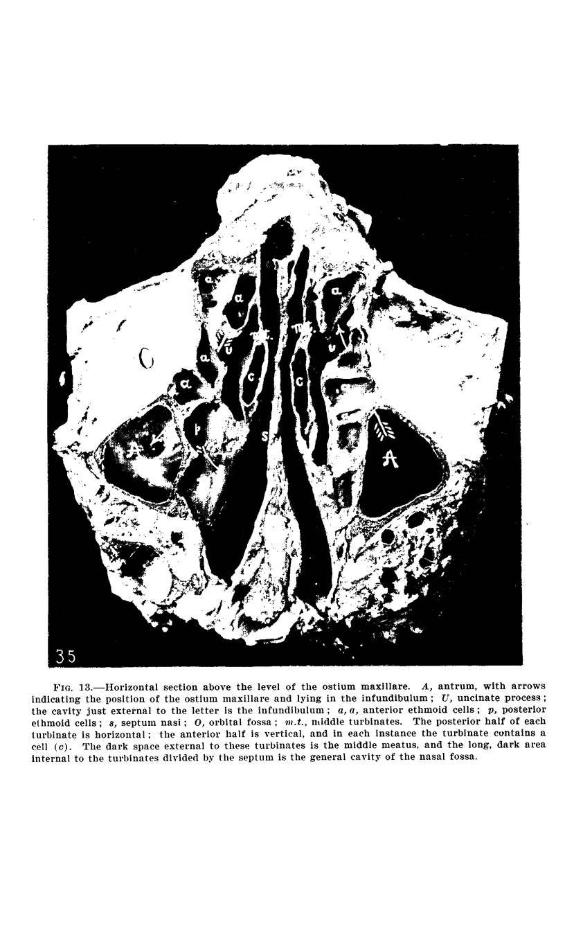 246-1
