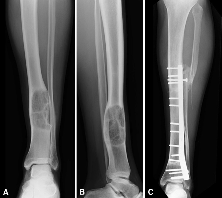 Fig. 1A–C