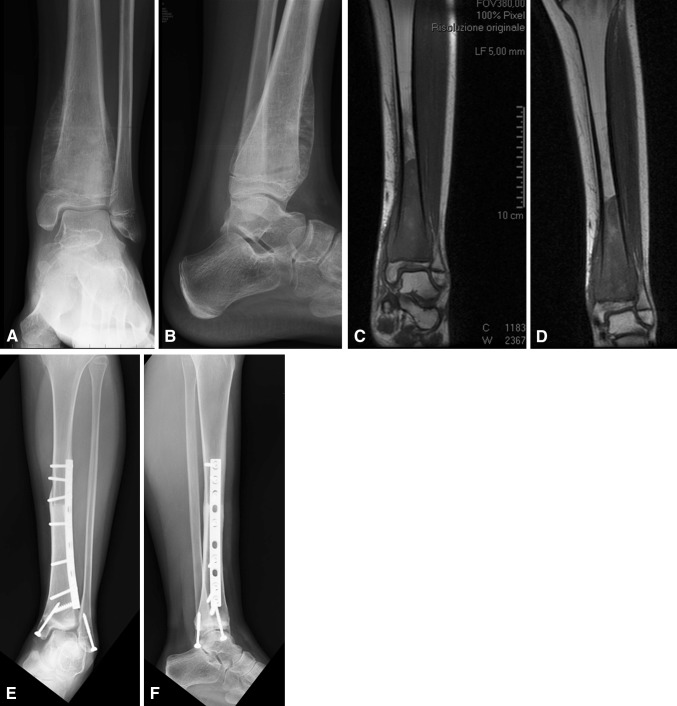 Fig. 5A–F