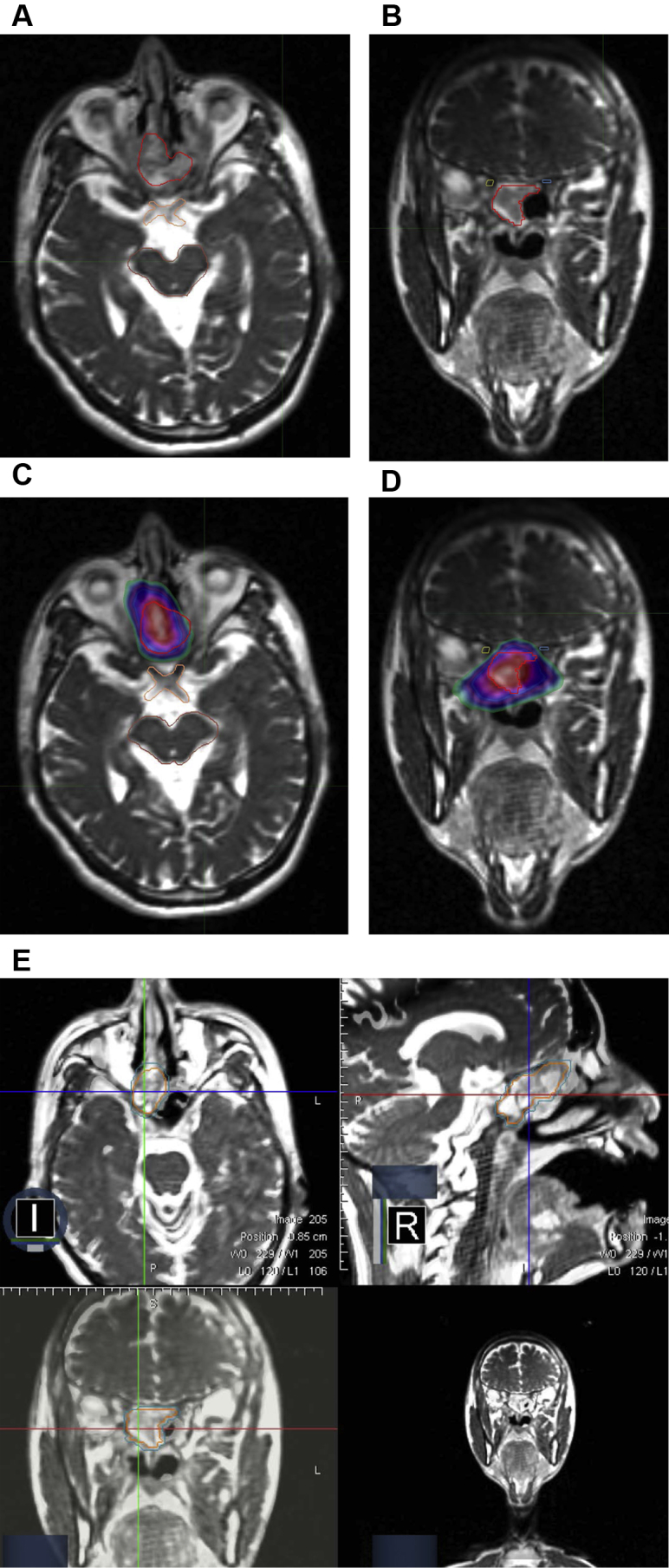 Figure 3