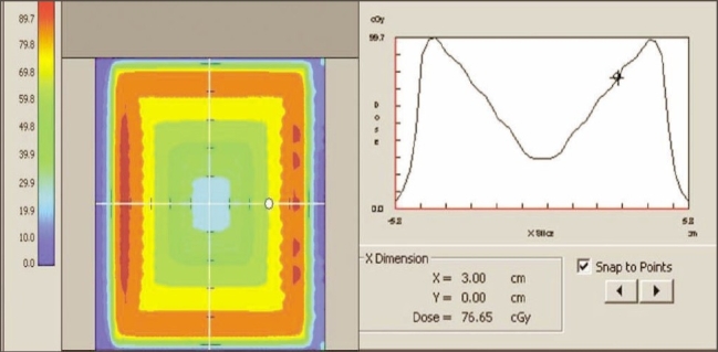 Figure 11b