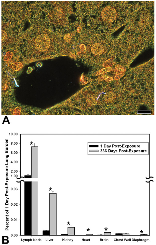 Figure 14.