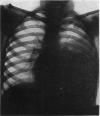 128-8