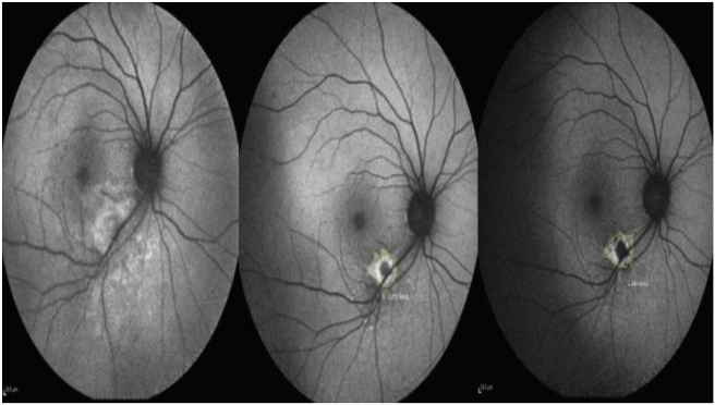 Fig. 2