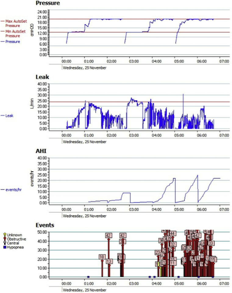 Fig. 3