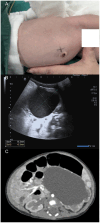 Fig. 1