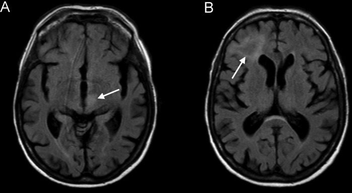 Figure 1