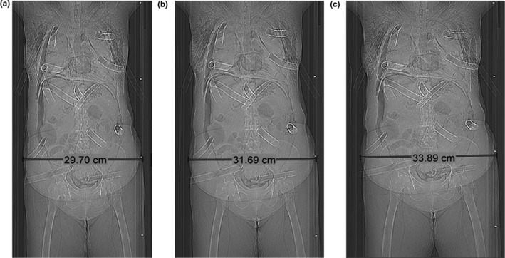 Figure 6