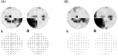 Fig 5