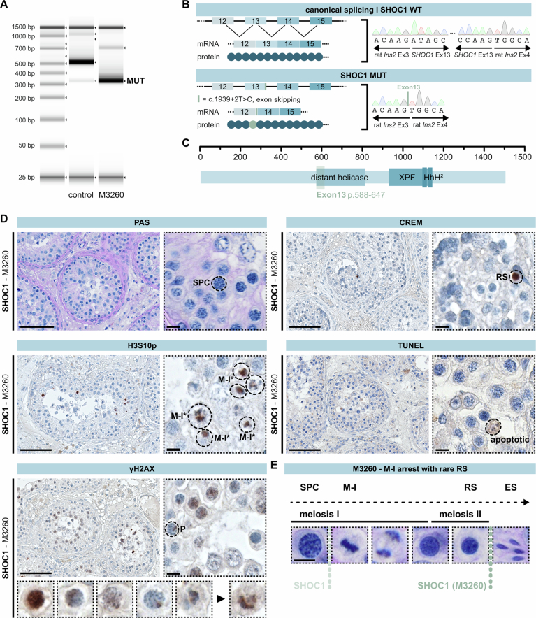 Genotype-specific differences in infertile men due to loss-of-function ...
