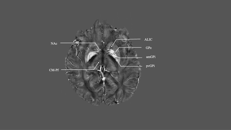 Fig. 1