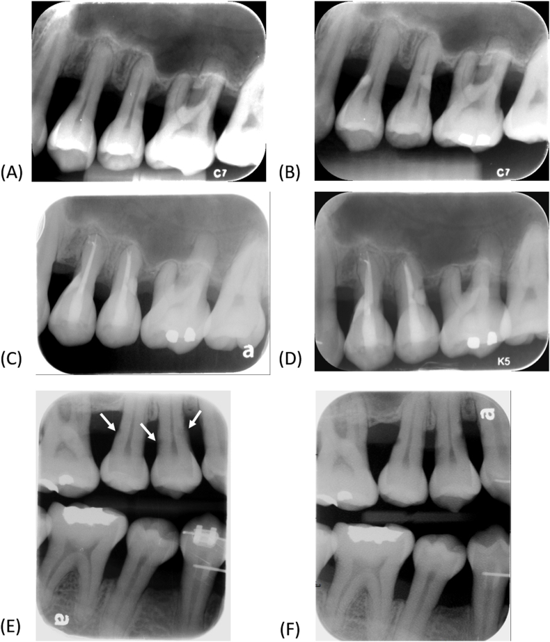 Fig. 4