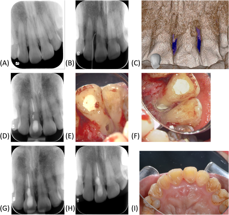 Fig. 1