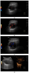 Figure 16