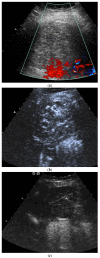 Figure 11