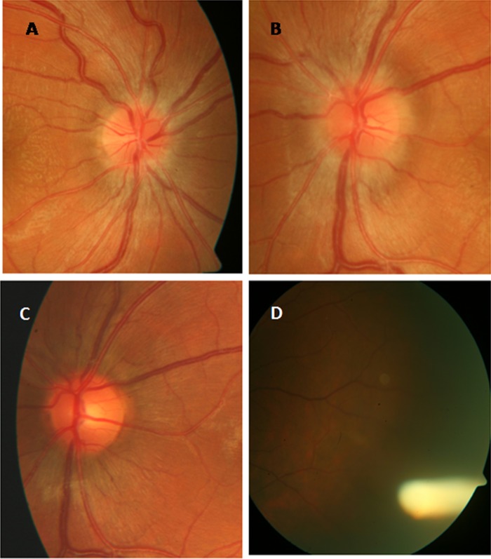 Figure 1