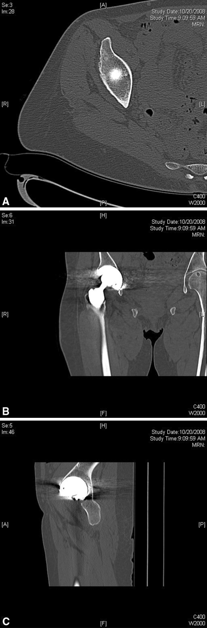 Fig. 1A–C