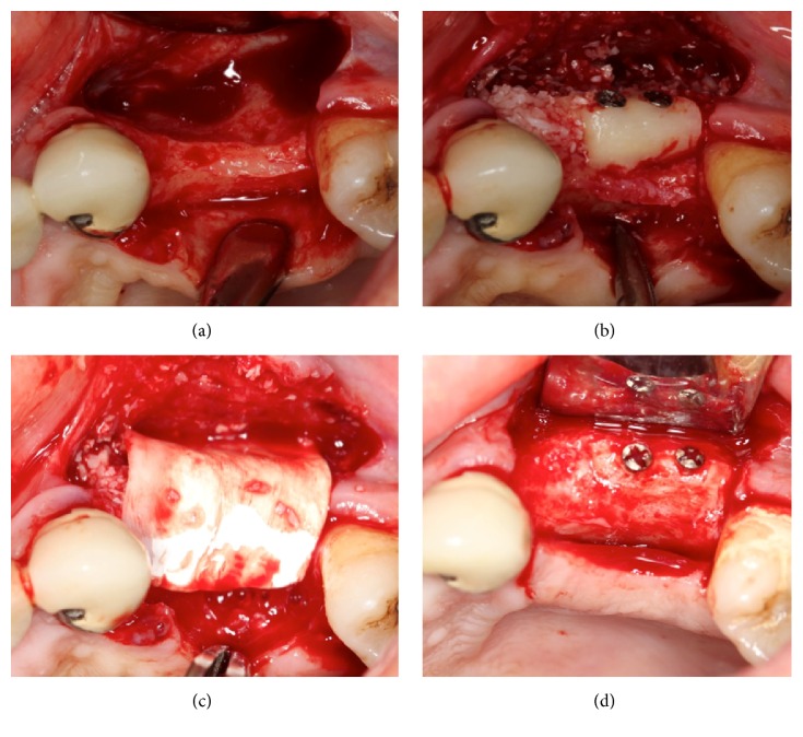 Figure 2