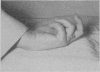 102
