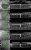 Fig. 3