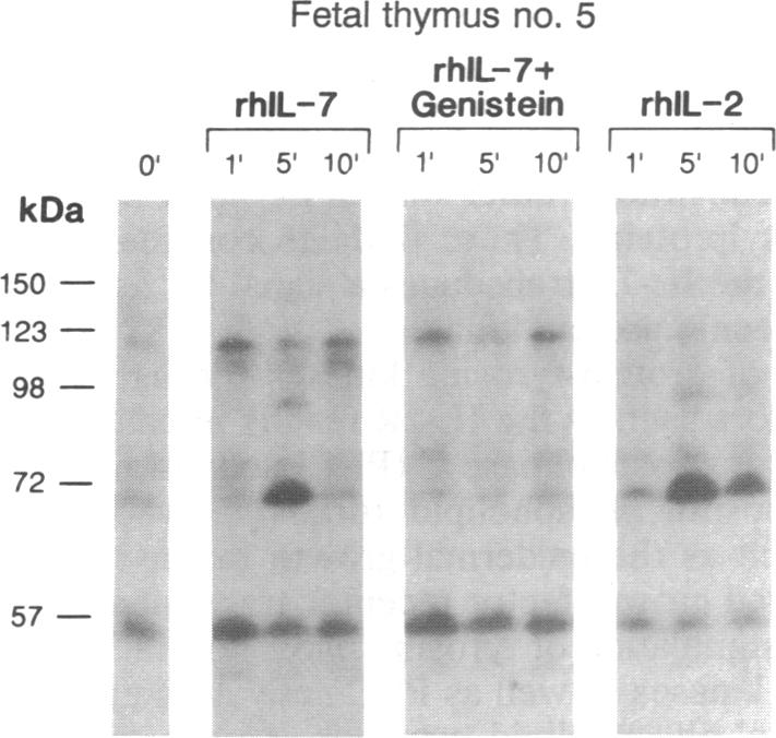 graphic file with name pnas01064-0396-d.jpg