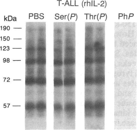 graphic file with name pnas01064-0396-c.jpg