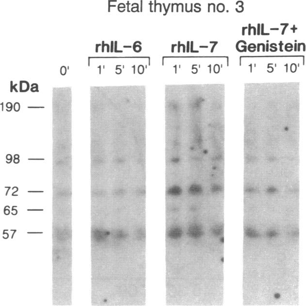 graphic file with name pnas01064-0396-a.jpg