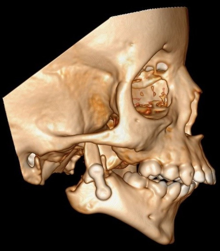 Figure 22