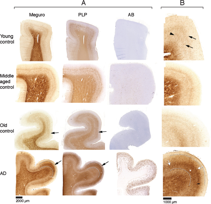 Fig.1