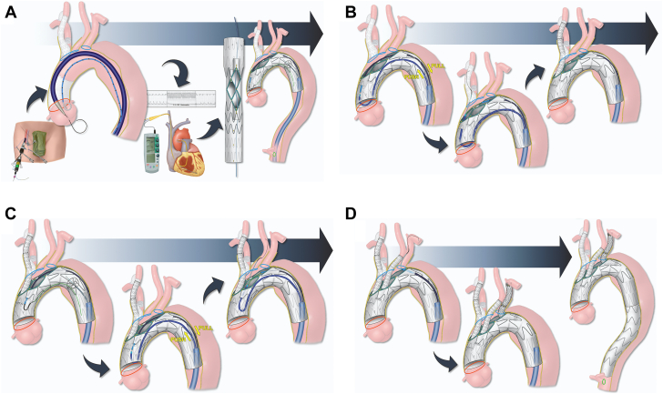 Figure 4