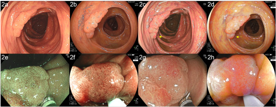 FIGURE 2