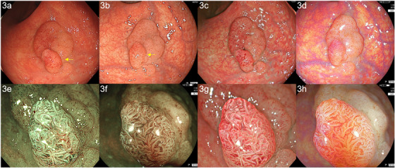 FIGURE 3