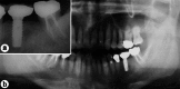 Fig. (7)