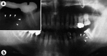 Fig. (3)
