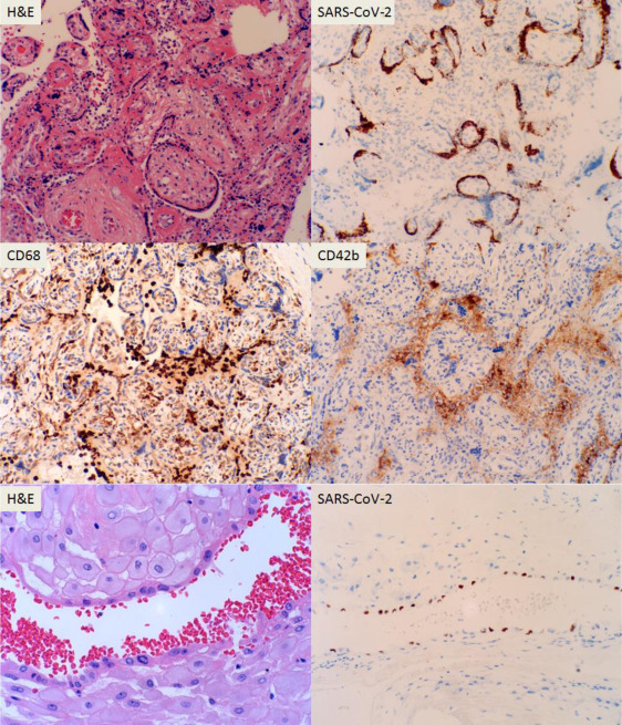 Figure 3