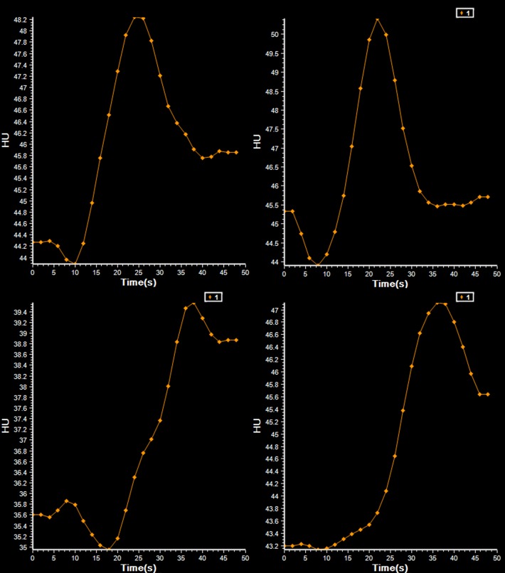 Fig 4