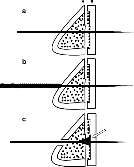 Fig. 2