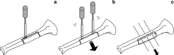 Fig. 1