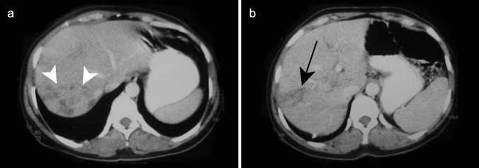 Fig. 18