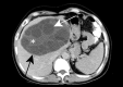 Fig. 10
