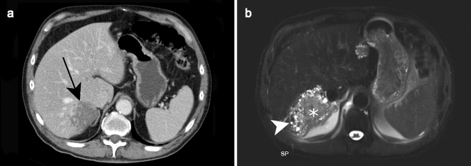 Fig. 15