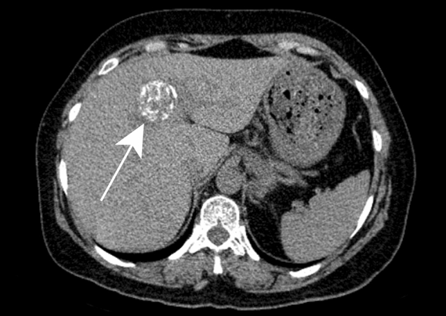 Fig. 11