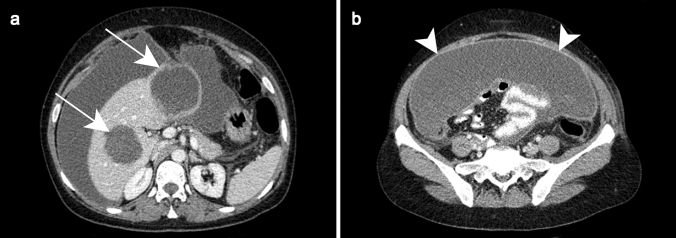 Fig. 13